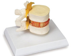 voorlichtingsmateriaal