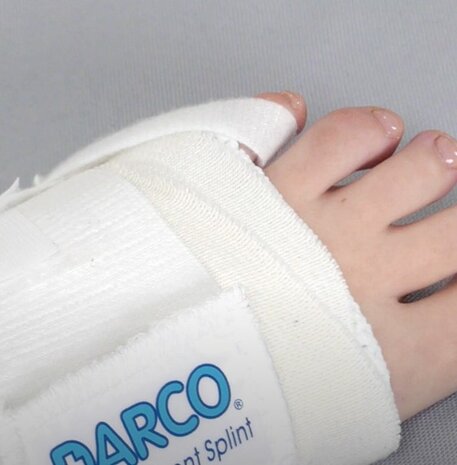 DARCO Toe Alignment Splint Dagspalk