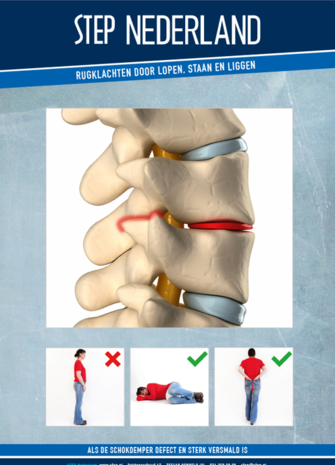 STEP Brochure: SDA - Rugklachten door lopen, staan en liggen