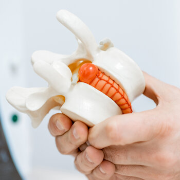 Lumbago, hernia en ischias klachten zijn Primair Discogene Aandoeningen (P.D.A.)